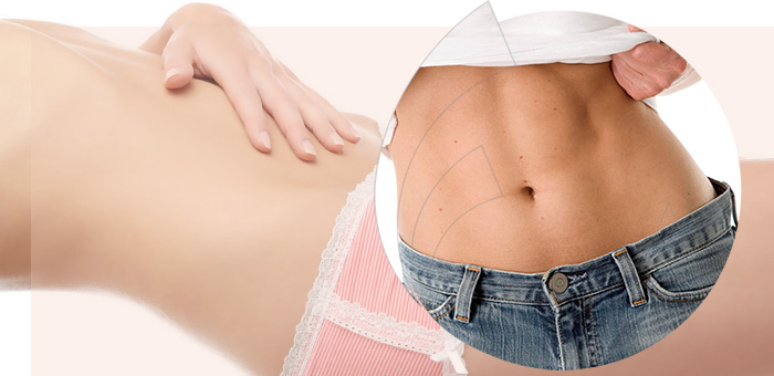 Cirurgia para retirada da gordura abdominal